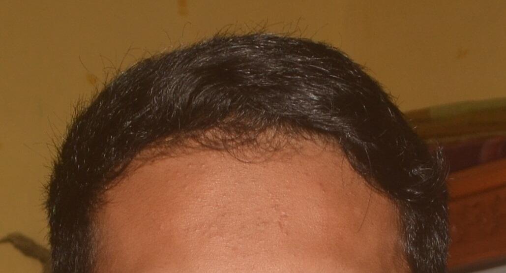 Gan cara lurusin rambut gimana?
