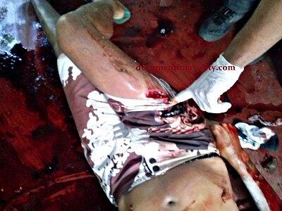 Shot Then Decapitated