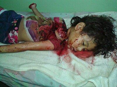 Mother Beheaded Daughter Then Attempted Suicide