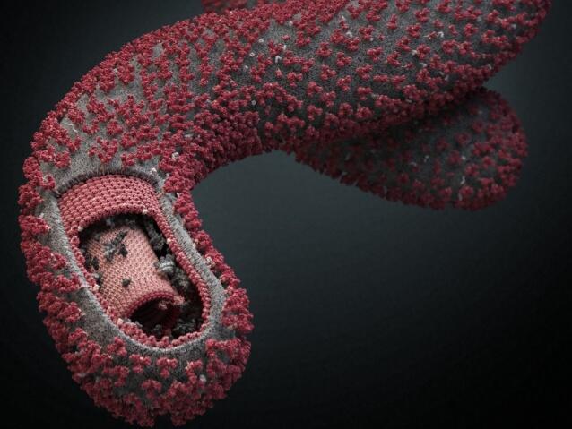 Begini Caranya Kamu Bisa Tertular Ebola