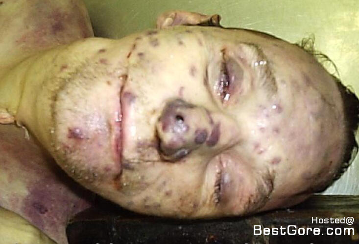 AIDS + Heroin = .....