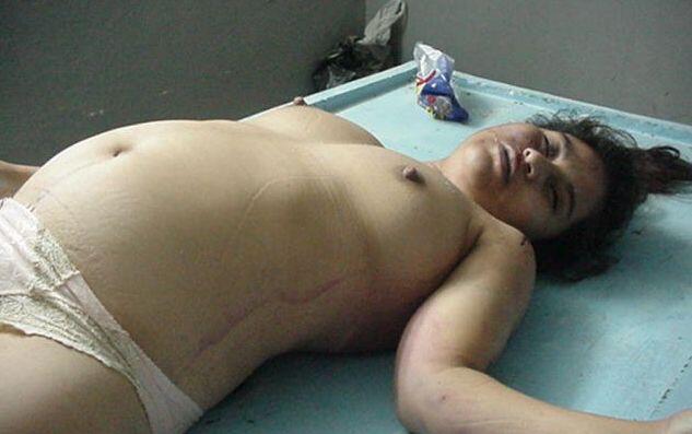 sex-photo-images-autopsy-of-teen-girl-punk