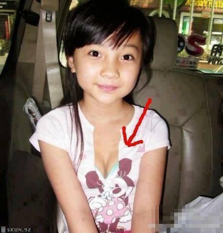 Pubertas Dini, Dada Siswi SD Di Jepang Membesar Lebih Cepat