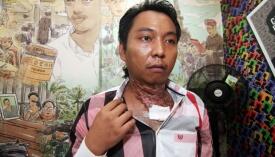 Dituduh Rampok, Pria Ini Disiksa 13 Polisi