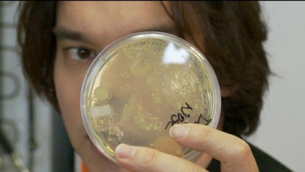 Jomblo? Salahkan Bakteri dalam Tubuh Agan