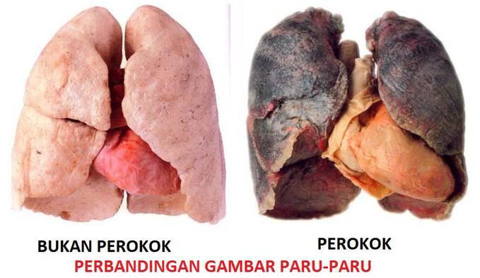 5 Manfaat Merokok Bagi Tubuh