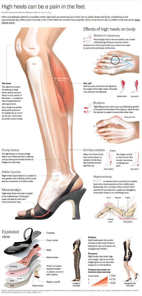 10 Gambar Unik Sepatu High Heels yang Mahal dan Ekstrim