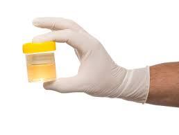 5 Kegunaan Luar Biasa Urine Di Masa Depan