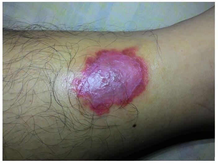 Help gan, kaki ane kenapa ya??
