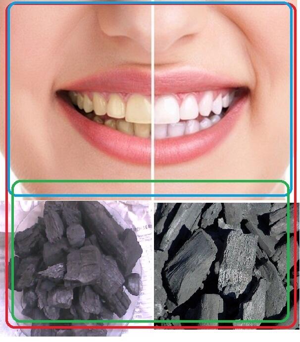 Beberapa Cara Unik Ini Pernah Dilakuakan Orang Untuk Merawat Gigi Mereka
