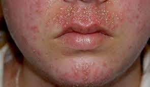 4 Pekerjaan Freelance Paling Membahayakan