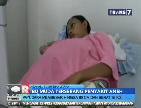 &#91;No Hoax&#93; Payudara Ibu Muda ini Membesar | NO BB++