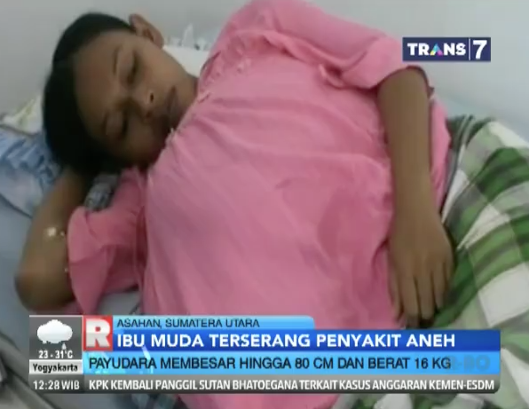 &#91;No Hoax&#93; Payudara Ibu Muda ini Membesar | NO BB++
