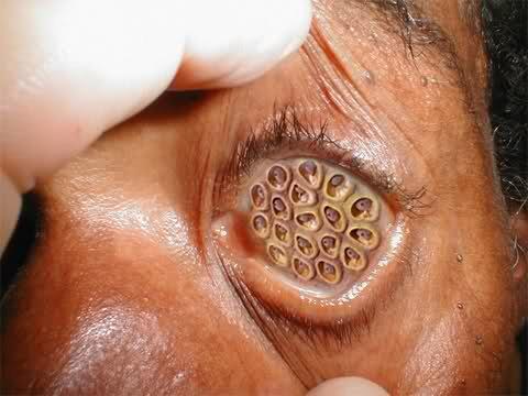 Tes trypophobia disini Gan