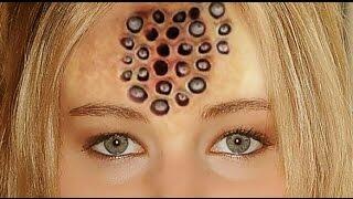 Tes trypophobia disini Gan