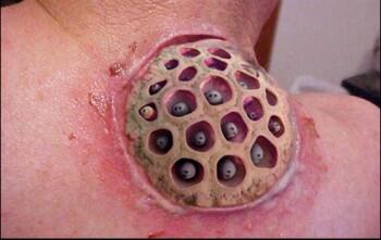 Tes trypophobia disini Gan