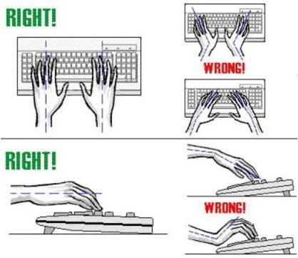 Mari Mengenal &quot;Carpal Tunnel Syndrome&quot;