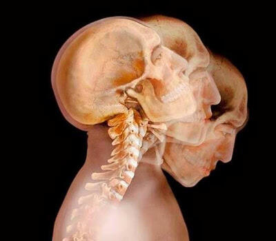 Foto-Foto Tubuh Manusia Versi X-Ray