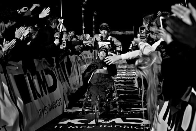 Kisah Saudara Kembar ini Bikin Haru Dunia