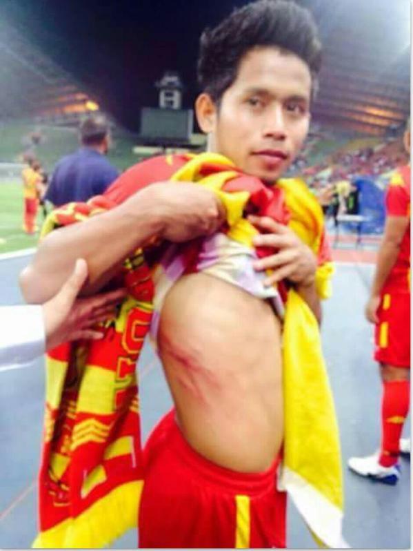 Cetak Gol 'Super-Kilat', Andik Vermansyah Sampai Berdarah-darah