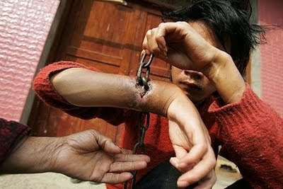 Ketika Rantai Menyatu Dengan Tangan Tahanan (ngeri+kasihan)