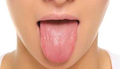 &#91;Healty&#93; Lidahmu Indikator Kesehatanmu