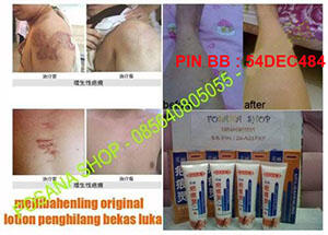 (^▿') -▹ CELL ROLLER-ALAT PENGHANCUR LEMAK,PENGHILANG SELULIT PERUT,PAHA,LENGAN,BETIS