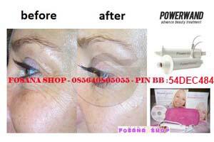(^▿') -▹ CELL ROLLER-ALAT PENGHANCUR LEMAK,PENGHILANG SELULIT PERUT,PAHA,LENGAN,BETIS