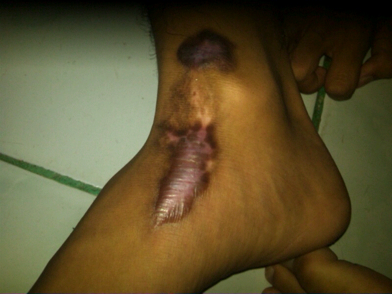 Kenapa kaki ane gan?