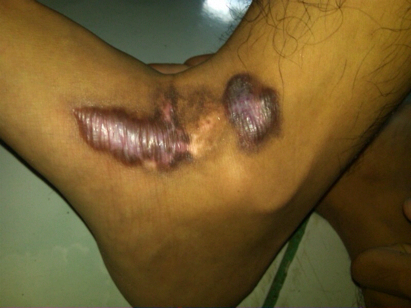 Kenapa kaki ane gan?