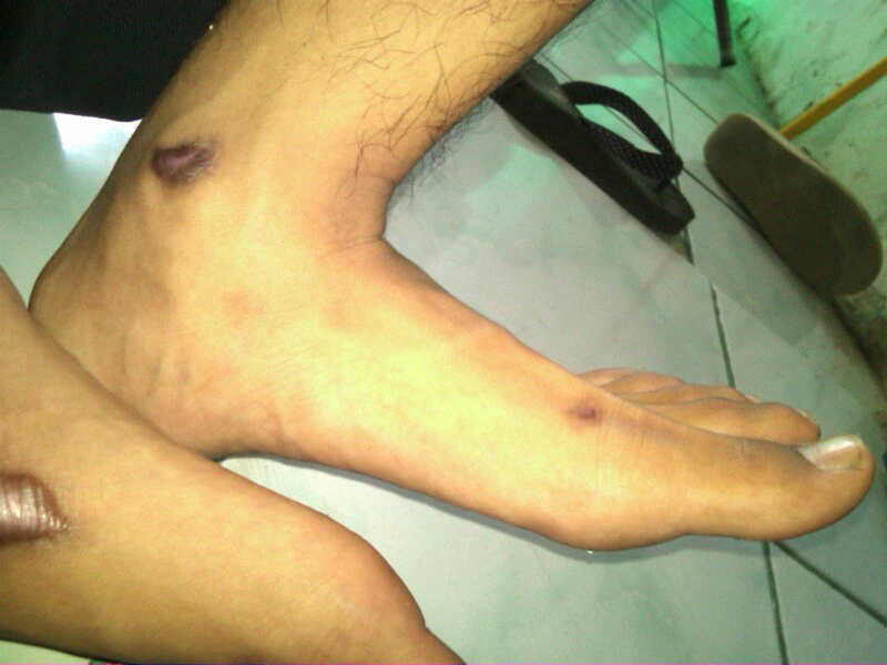 Kenapa kaki ane gan?
