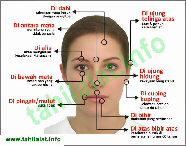&#91;Agan Harus Tahu&#93; Semua Tentang &quot;TAHI LALAT&quot; 
