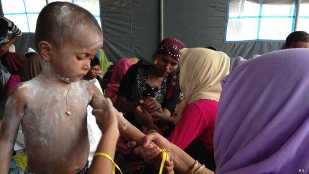 Nasib anak-anak dan perempuan pengungsi Rohingya di Aceh &#91;Miskin Masih Buat Anak&#93;