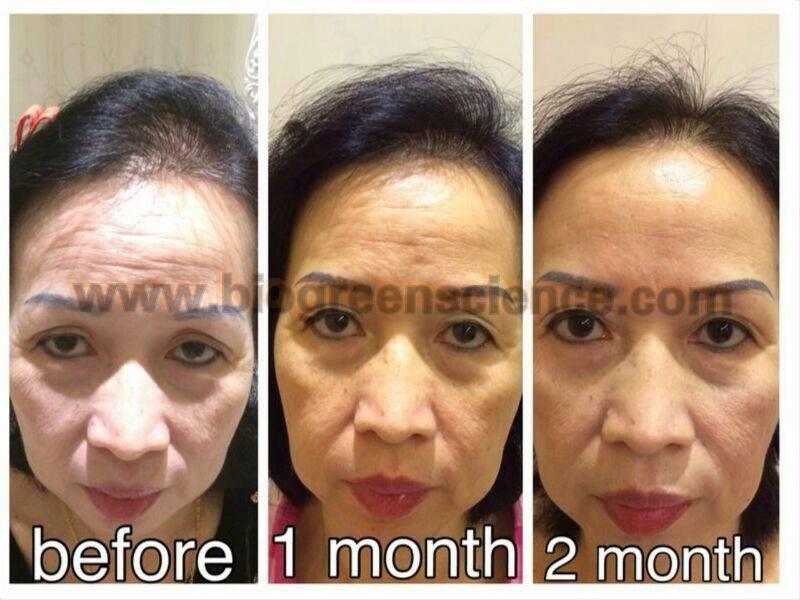 ORANG PINTAR? BISNISNYA INI! INCOME UNLIMITED BISA SAMPAI MILYARAN/BULAN