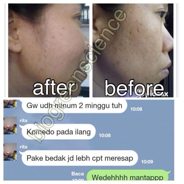 ORANG PINTAR? BISNISNYA INI! INCOME UNLIMITED BISA SAMPAI MILYARAN/BULAN