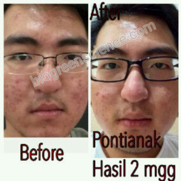 ORANG PINTAR? BISNISNYA INI! INCOME UNLIMITED BISA SAMPAI MILYARAN/BULAN