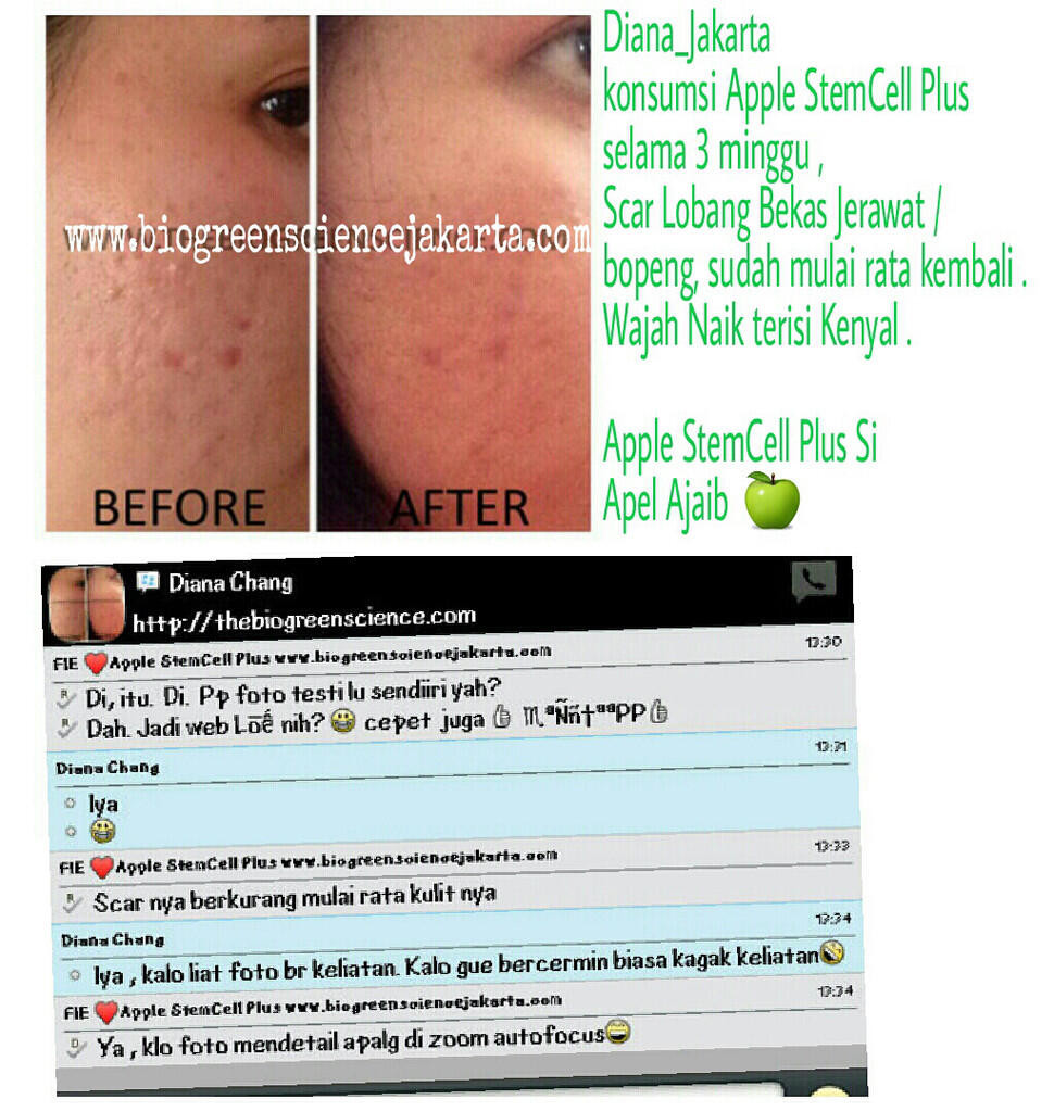 ORANG PINTAR? BISNISNYA INI! INCOME UNLIMITED BISA SAMPAI MILYARAN/BULAN
