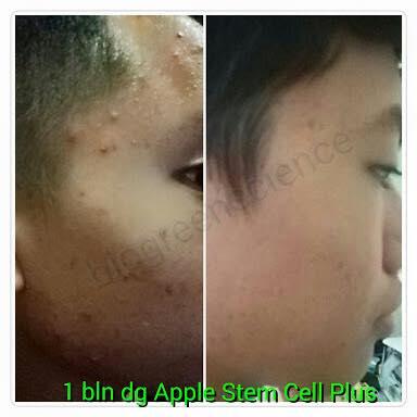 ORANG PINTAR? BISNISNYA INI! INCOME UNLIMITED BISA SAMPAI MILYARAN/BULAN
