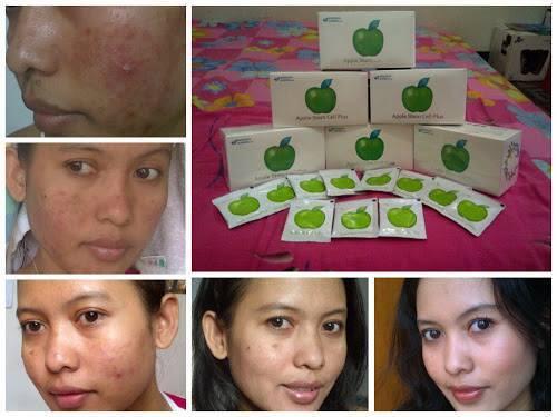 ORANG PINTAR? BISNISNYA INI! INCOME UNLIMITED BISA SAMPAI MILYARAN/BULAN