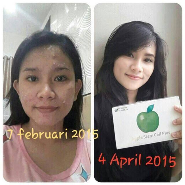 ORANG PINTAR? BISNISNYA INI! INCOME UNLIMITED BISA SAMPAI MILYARAN/BULAN