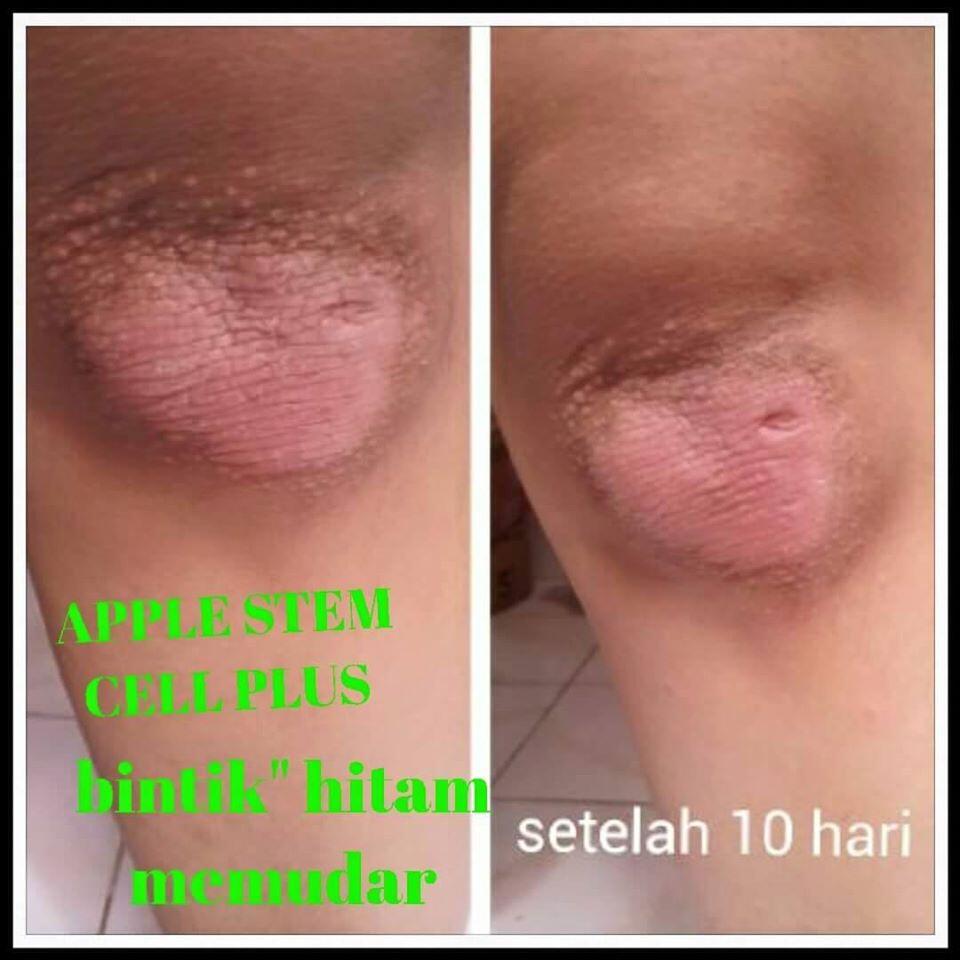 ORANG PINTAR? BISNISNYA INI! INCOME UNLIMITED BISA SAMPAI MILYARAN/BULAN