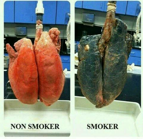 Kandungan rokok dan akibatnya
