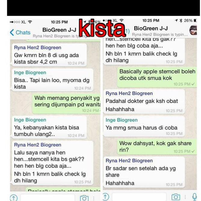 ORANG PINTAR? BISNISNYA INI! INCOME UNLIMITED BISA SAMPAI MILYARAN/BULAN