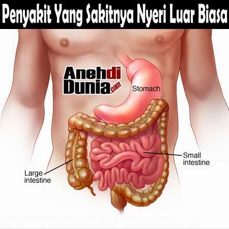 Penyakit Yang Sakitnya Nyeri Luar Biasa