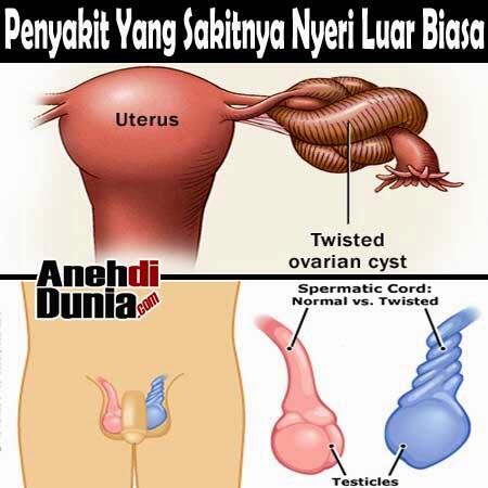 Penyakit Yang Sakitnya Nyeri Luar Biasa