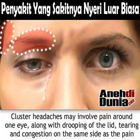 Penyakit Yang Sakitnya Nyeri Luar Biasa