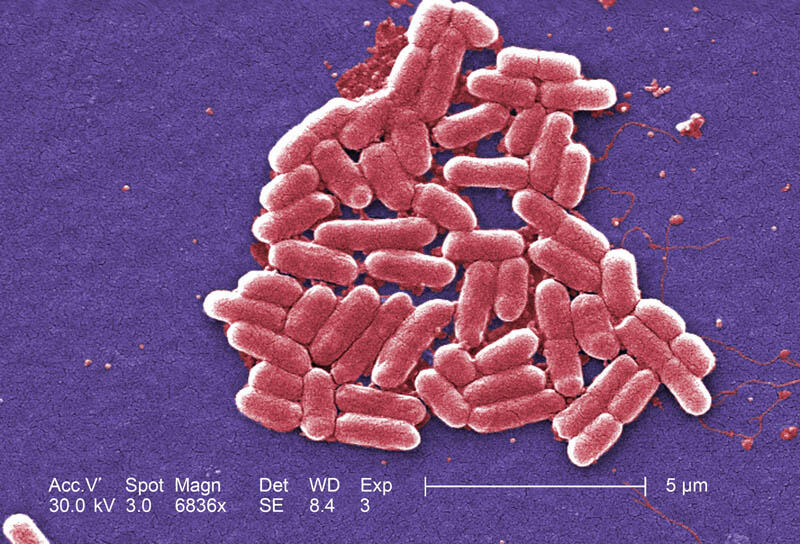 Mekanisme Kerja Antibiotik