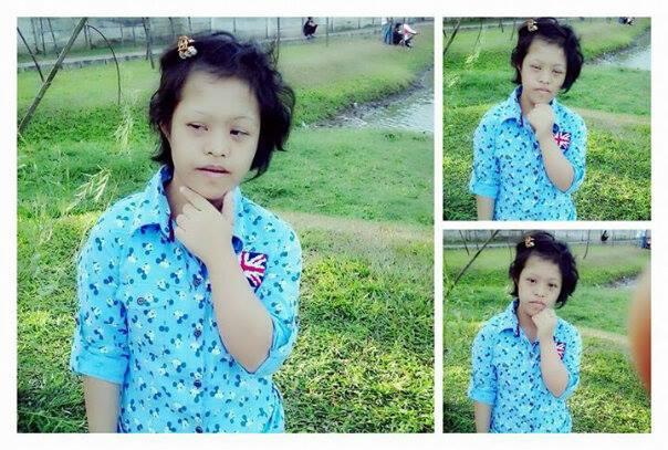 &#91;ANAK HILANG&#93; cewe, yatim piatu, Down Syndrom, TB 130cm dan BB 40kg