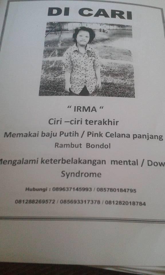 &#91;ANAK HILANG&#93; cewe, yatim piatu, Down Syndrom, TB 130cm dan BB 40kg