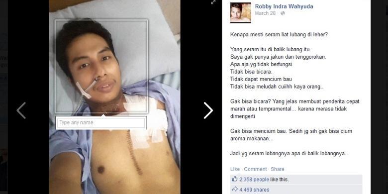 RIP Robby yang Kehilangan Jakun karena Meroko Meninggal.